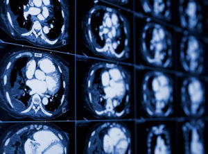 Citrus County FL MRI