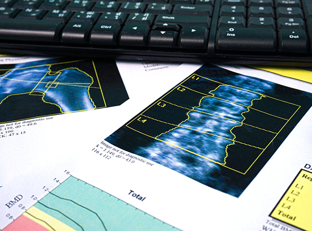 dexa-scan Medical Imaging Services