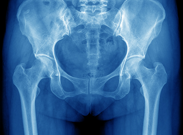 digital-x-ray Medical Imaging Services