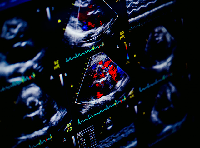 echocardiography Citrus County FL MRI