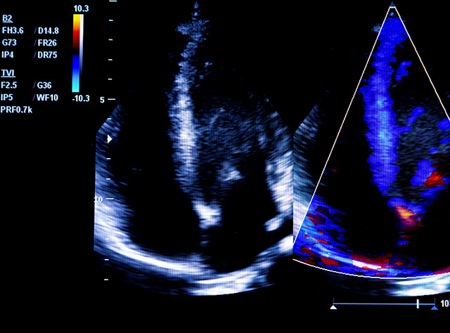 ultrasound Medical Imaging Services