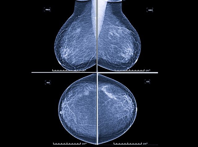 Citrus County FL MRI